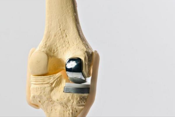 تولید محصولات پروتز در کلینیک ارتوپدی آریا طب